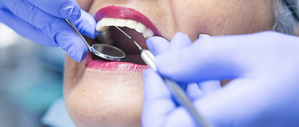 Best Emergency Cosmetic Dentistry in Plattsburgh West, NY